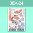 Плакат «Синдром запястного канала (кистевой туннельный синдром)» (ЗОЖ-24, ламинированная бумага, A2, 1 лист)